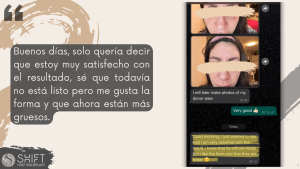 Reseña de trasplante de cejas con SHIFT Hair en Turquía 06 3