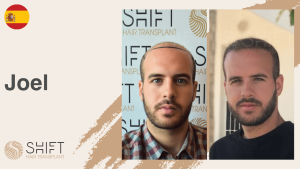 A thumbnail for a hair transplant video testimonial at SHIFT Hair in Turkey by Mr Joel
