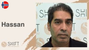 Una miniatura de un testimonio en vídeo sobre trasplante capilar en SHIFT Hair en Turquía realizado por el Sr Hassan
