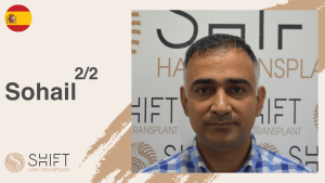 Una miniatura de un testimonio en vídeo sobre trasplante capilar en SHIFT Hair en Turquía realizado por el Sr Sohail 2