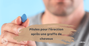 Image vedette de l'article Pilules d'érection après greffe de cheveux par SHIFT Hair en Turquie Istanbul