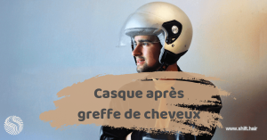 L'image en vedette de l'article « Casque après greffe de cheveux » de SHIFT Hair en Turquie Istanbul