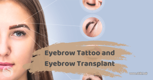 Eyebrow Tattoo and Eyebrow Transplant 3