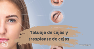 Tatuaje de Cejas y Trasplante de Cejas 3