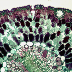 Thérapie d’exosomes SHIFT Hair 3