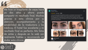 Reseña de trasplante de cejas con SHIFT Hair en Turquía 17 3