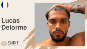Una miniatura de un testimonio en vídeo sobre trasplante capilar en SHIFT Hair en Turquía realizado por el Sr Lucas Delorme 3